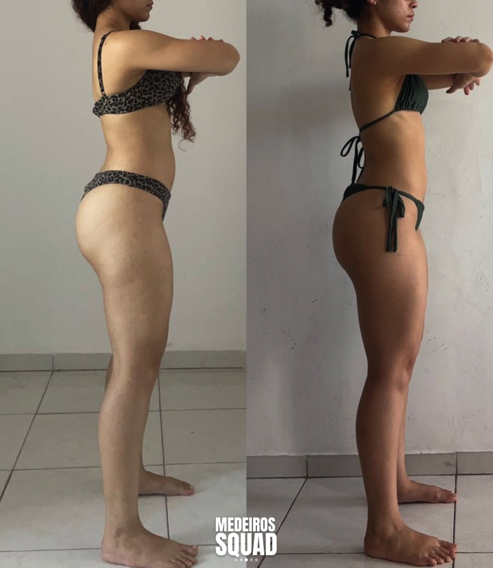 Antes e depois: progresso de aluna acompanhada no Medeiros Squad